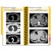 MDpocket® Radiology & Imaging Edition